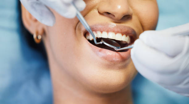 Best Broken or Chipped Tooth Repair in Knob Noster, MO